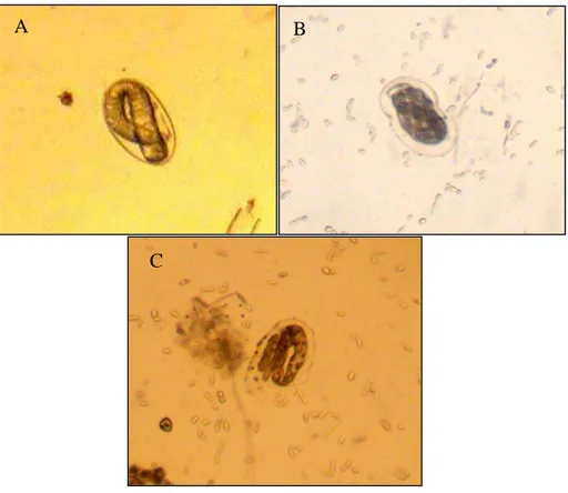 Figura  1  -  Ovo  larvado  de  Haemonchus  contortus    A:  Ovo  com  aspecto  normal  de  desenvolvimento,  proveniente  do  controle  negativo  com  água  estéril;  B  e  C:  Ovos  com  alteração  morfológica  da  casca  e  do  embrião,  oriundos  do  t