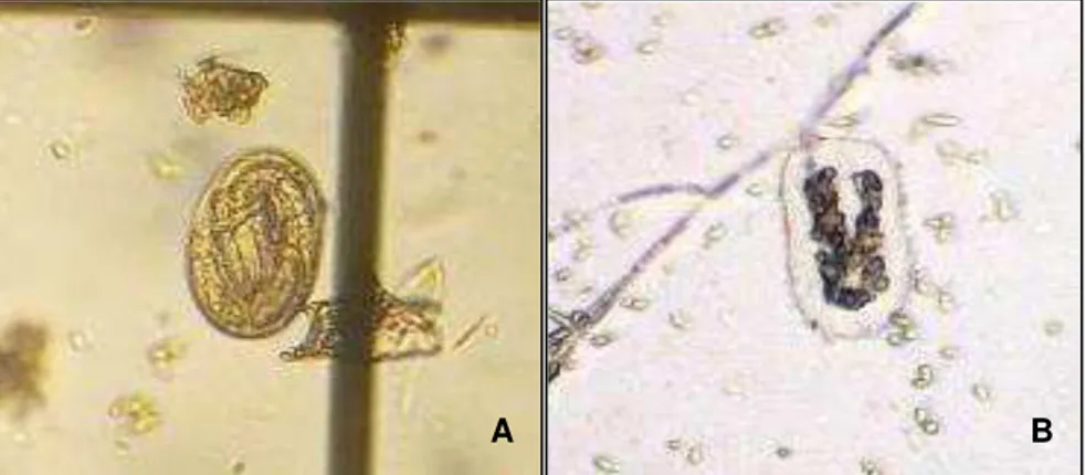 FIGURA  1:  Ovo  larvado  de  Haemonchus  contortus  A:  Ovo  com  aspecto  normal  de  desenvolvimento,  proveniente  do  controle  negativo  com  água  estéril; B: Ovo com alteração morfológica da casca e do embrião, proveniente  do tratamento com filtra