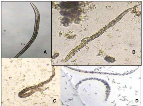 FIGURA 2: A: Larva de primeiro estágio de Haemonchus contortus A: L1 com  aspecto  normal  de  desenvolvimento,  proveniente  do  controle  negativo  com  água estéril; B: L1 com alteração morfológica, proveniente do tratamento com  filtrado de Aspergillus