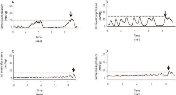 Figure 4. Representative traces showing spontaneous contractions and peak pressure (arrow) during the illing phase for (A) DMSO, (B) L-NAME (LN; 20 mg/rat/day),  (C) BAY 41-2272 (10 mg/kg/day) and (D) LN + BAY 41-2272 groups.