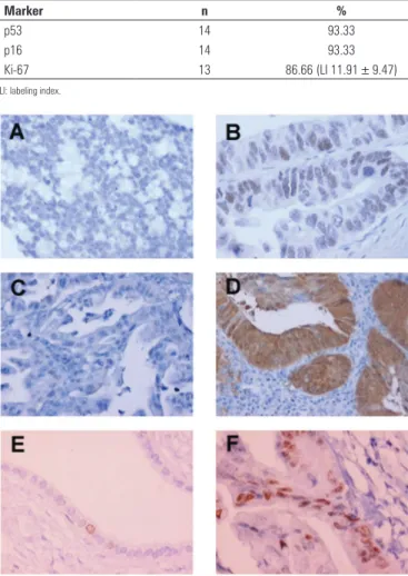 Table 1. Overall immunostaining
