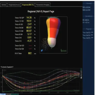 Figure 7. Demonstrating measurement of three-dimensional dyssynchrony  index of the left ventricle (Tmsv 16-SD): 14.28%, in patient with preserved  three-dimensional ejection fraction, 3D LVEF: 66.5%