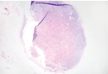 Figure 2. Stimulated lymph node with predominance of the cortical region,  showing stimulated follicles (magnification 100x)