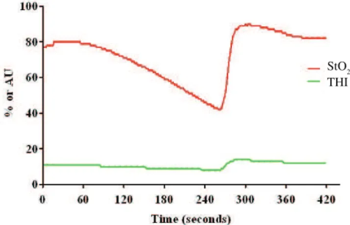 Figure 3. Schematic representation of StO 2  and THI (total hemoglobin index)  curves during a dynamic occlusive test with Near-infrared Spectroscopy (NIRS)  technique