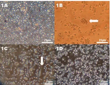 Figure 2. Morphological analysis of the osteodifferentiation process of  hUCB-OPC. (A) Cells with cuboidal shape (white arrow) after 14 days in  contact with osteoinductive medium