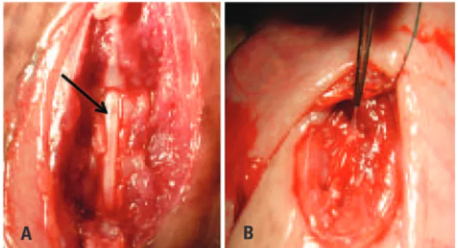 Figure 1. Induced meningomyelocle defect on the 90th gestational day. (A) The  arrow shows the exposure of the spinal canal with a fully preserved dura mater