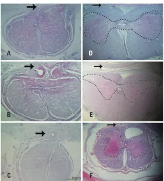 Figure 4. Medullar anatomopathological image (hematoxylin-eosin); the  simplified technique was used for the correction of the defect (Group 2),  the cellulose can be observed (arrow head) as well as the neodura mater  (thin arrow)