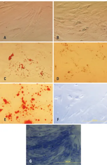 Figure 4. (A) Undifferentiated mesenchymal stem cells – CTRL (40x). (B) Lipid  droplet formation within cells cultured in adipogenic medium (40x)