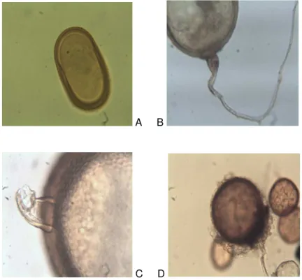 FIGURA 4 - Esporos de espécies de FMAs identificadas; Acaulospora 