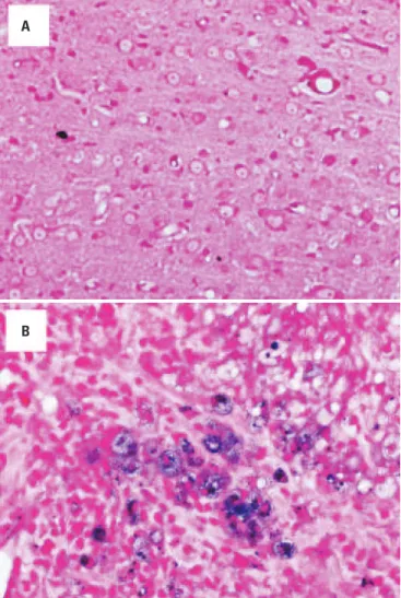 Figure 4. Histological analysis of tumor tissues (basic fuchsine protocol and  counterstaining with Prussian Blue)