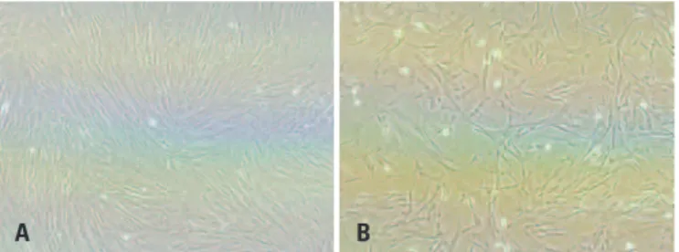 Figure 1. Mesenchymal stem-cells isolated from samples of umbilical cord. A)  MSC culture with approximately 90% of confluence – 400x; B) MSC culture with  approximately 80% of confluence
