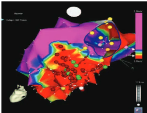 Figura 1. Eletrocardiograma apresentando taquicardia clínica em Unidade  Primeiro Atendimento