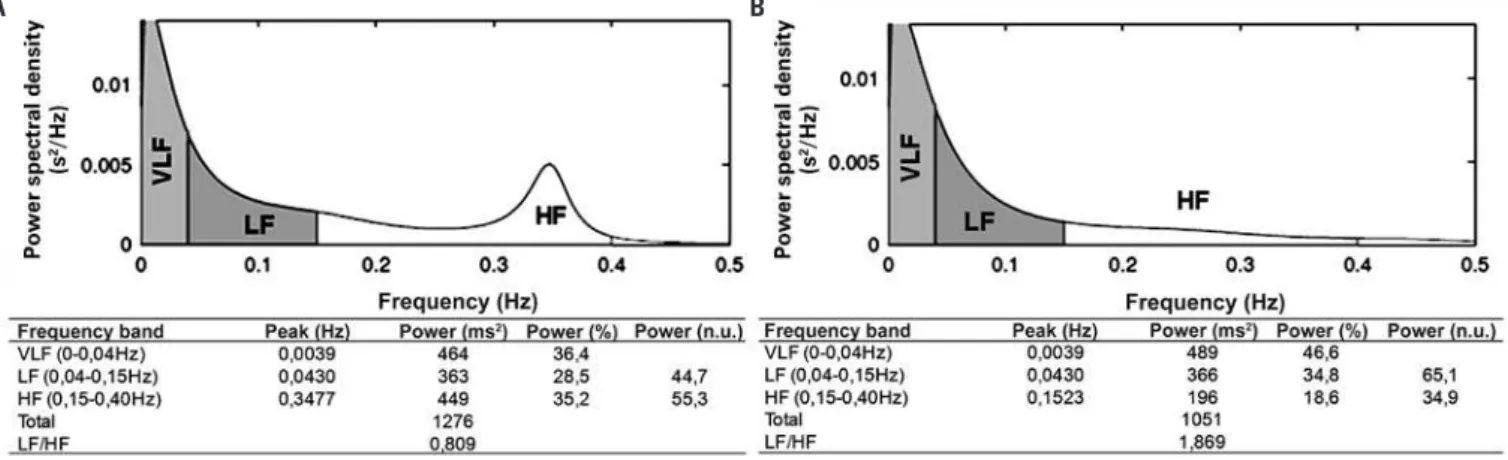 Figure 1. Spectral analysis of frequency using auto regression model, with order model 12 as per Akaike criterion for obese adolescents