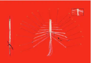 Figure 1.  Demonstration of the technique used to isolate and identify the spinal  cord segment L6-S1, in which where the probe was implanted