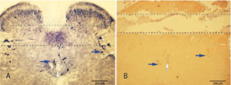 Figure 4. (A) Time course of nitric oxide metabolites (NOx) concentrations  (mean±SEM) present in samples obtained through a microdialysis probe  implanted in the subarachnoid space (segment level L6-S1) from a group of  normal rats (normal), a group of no
