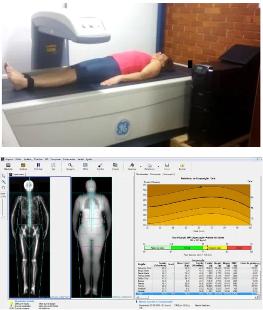 Figura  11.  Registro  fotográfico  de  uma  voluntária  durante  a  avaliação  do  DEXA