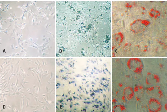Figure 1. Photomicrograph of bone marrow (A to C) and adipose tissue (D to F) mesenchymal stem cells in the undifferentiated stage (A and D) and subjected to  osteogenic (B and E) and adipogenic differentiation (C and F)