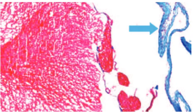 Figure 7. Photomicrography of a rat in Mesh Group (hematoxylin-eosin, 400x)  indicated the presence of neovessels in the dura mater