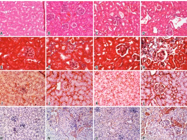 Figure 2. Representative pictures of hematoxylin and eosin, Masson’s trichrome staining, and profibrotic markers (collagen IV and S100A4) in the kidney of Immpl2  mice and wild type controls