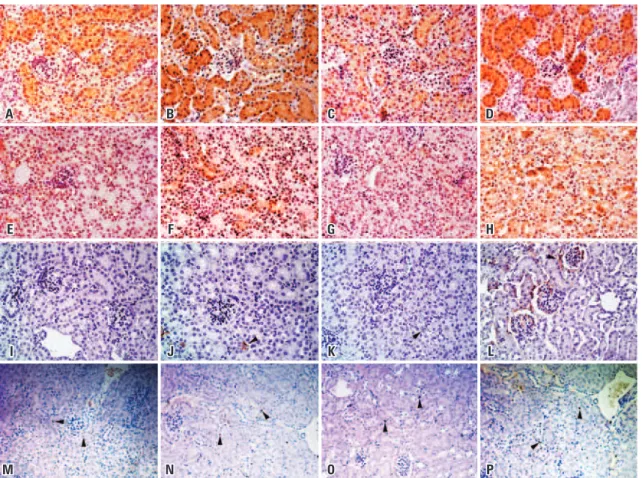 Figure 4. Representative pictures of superoxide dismutase 1, 4-hydroxynonenal, CD68-positive cells, and the apoptotic cells in the kidney of Immpl2 mice