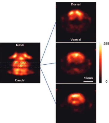 Figure 5. Cerebral perfusion image with HMPAO- 99m Tc. Horizontal section  and three coronal sections through the reconstructed model of the  radiopharmaceutical HMPAO- 99m Tc distribution in the brain of a normal rat