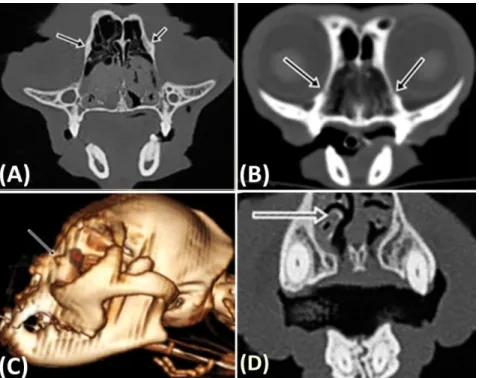 Figure 2. A – Cross-sectional image acquired at the level of the infraorbital foramen
