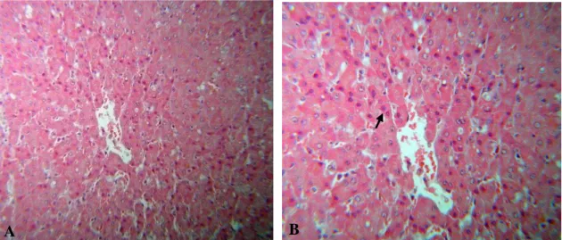 Figura  3.  Secção  histológica  do  fígado  de  um  bubalino  com  sinais  clínicos  de  fotossensibilização  hepatógena