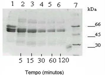 Figura  5  –  Ação  fibrinogenolítica  de  CMS2MS2.  Clivagem  progressiva  do  fibrinogênio  ao  longo  do  tempo (0 120 min) medido por eletrofore (SDS-PAGE 10%)