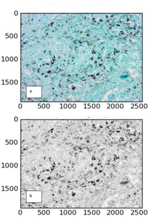 GRÁFICO 1  – a) Original image; b) Grayscale image 