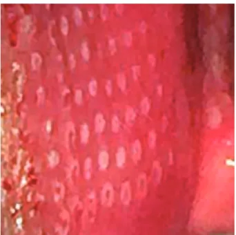 Figure 1. Vaginal pen with 64 microneedles