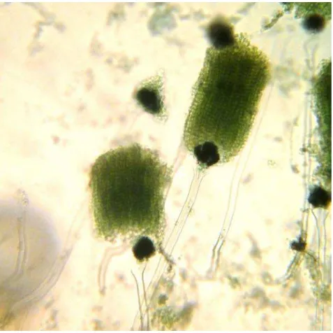 FIGURA 2  – Microscopia de Aspergillus spp. isolado do rúmen de novilho de 