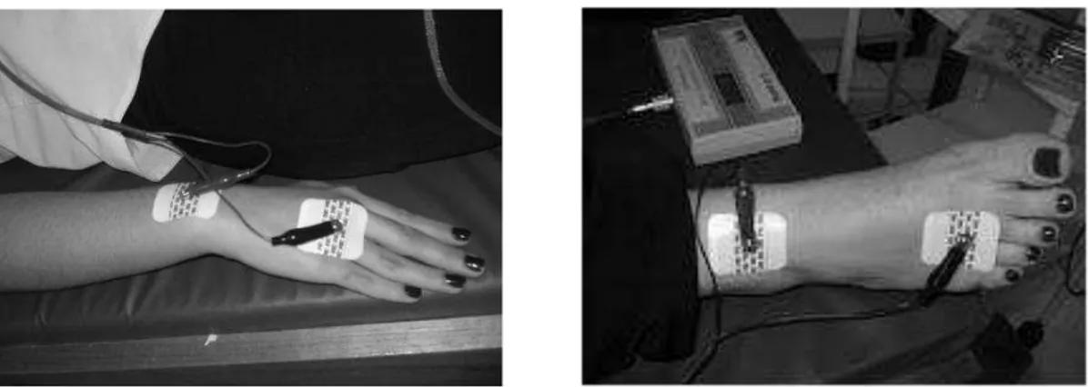 Figura  3  -  Posição  para  fixação  de  eletrodos  no  pé  e  na  mão  para  a  análise  de  bioimpedância