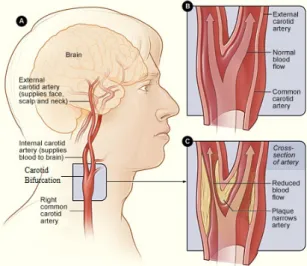 Fig. 1.4: Carotid artery: A- location of the right carotid artery in the head and neck;