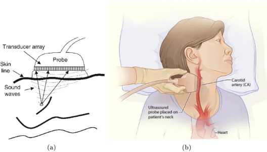 Fig. 1.7: Example of ultrasound principle and acquisition of carotid ultrasound image: