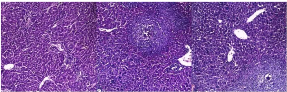 Figure 1 – Form the left to the right: mice microscopic images of normal and two degrees of  hepatic granuloma