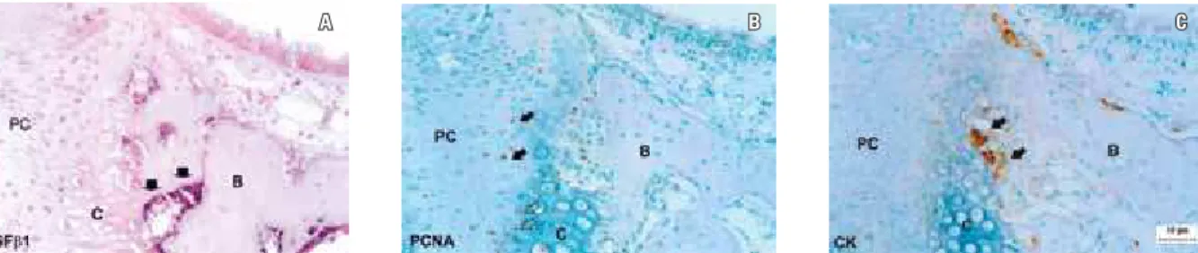 FIGURE 2 - Expression of TGF ß 1 mRNA ( A ), PCNA ( B ) and CK ( C ) on day 0. TGF ß 1: transforming growth factor  ß 1; PCNA: proliferating cell nuclear antigen; 