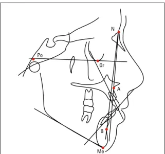 FIGURE 4 - Cephalometric tracing showing landmarks and lines.