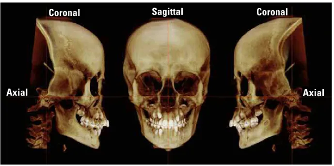 FIGURE 2 - Three-dimensional image of the head position after standardization by the axial, coronal and sagittal reference planes