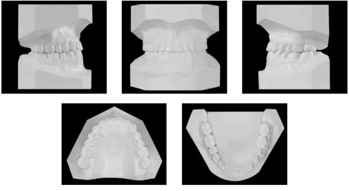 FIGURE 8 - Final radiographs:  A ) Panoramic and  B ,  C ) incisor periapical.
