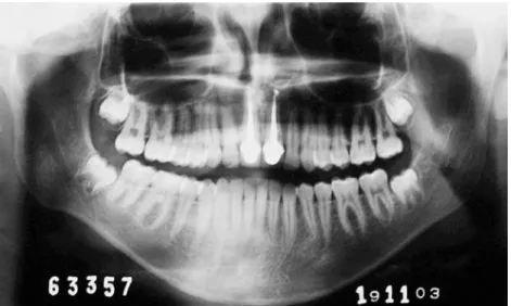 FIGURE 6 - Initial facial appearance. FIGURE 7 - Initial radiographic appearance.