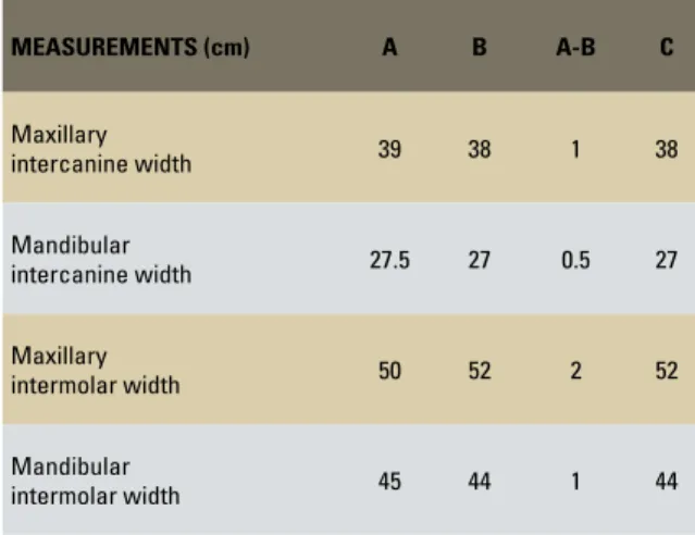 TABLE 2 - Maxillary and mandibular intercanine and intermolar widths. 