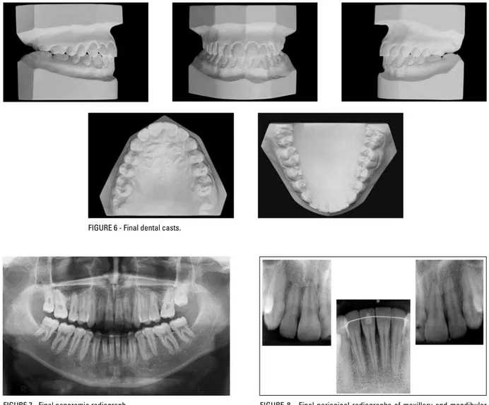FIGURE 7 - Final panoramic radiograph. FIGURE  8  -  Final  periapical  radiographs  of  maxillary  and  mandibular  incisors.