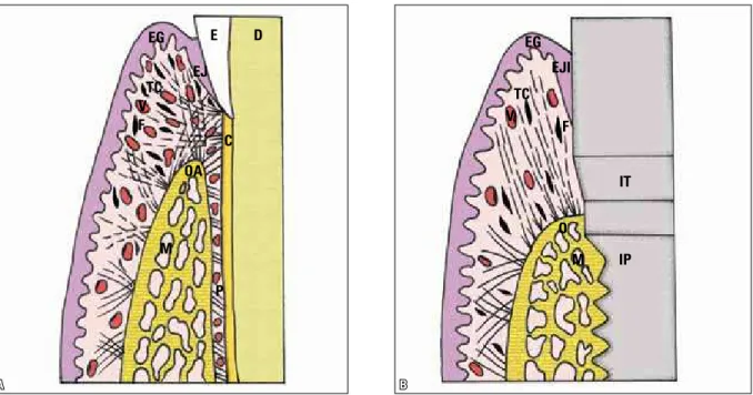 FIGURA 1 - No periodonto normal, em  A , destacam-se as fibras colágenas gengivais partindo da crista óssea alveolar (OA) para o cemento (C), gengiva  e ligamento periodontal (P) para formar uma trama na e da inserção conjuntiva