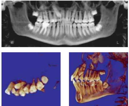 FIGURE 8 - Cone beam tomographic images. 