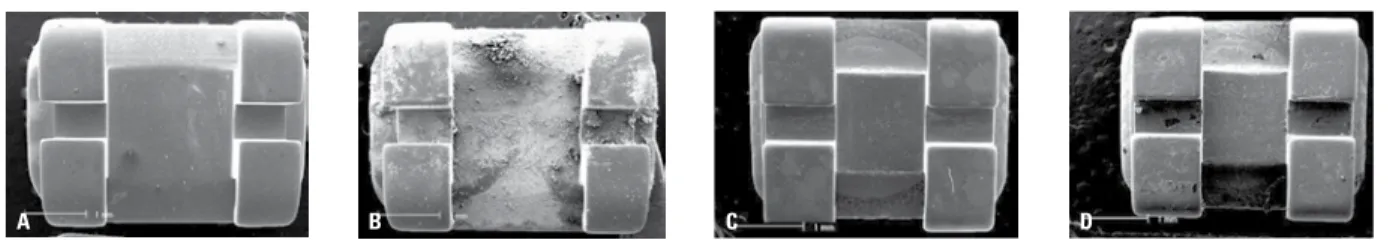 FIGURE 1 - General view (50x) of the brackets in Group A at T0 ( A ) and T5 ( B ) and general view (50x) of the brackets in group B at T0 ( C ) and T5 ( D )