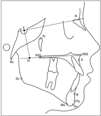 FIGURE 2 - Lateral cephalogram and location of cephalometric landmarks.
