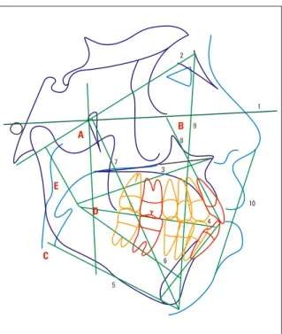 TABLE 1 - Ricketts’ VERT angles.