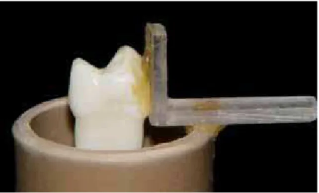 FIGURE 1 - Tooth-square set bonded to PVC tube with sticky wax.
