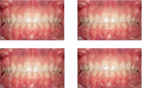 FIGURE 3 - Example of using the same image with different resolutions and therefore different file sizes: A) 10 MP (3,869 Kbytes), B) 8 MP (3,239 Kbytes),  C) 5 MP (667 Kbytes) e D) 3 MP (483 Kbytes).