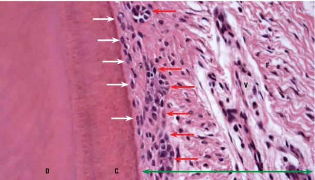 FIGURE 1 - On the root surface the cementum is covered by cementoblasts (white arrows)